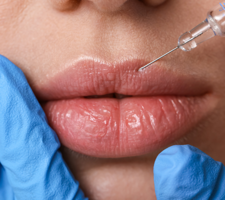 Fillers in Bayonne for Men and Women: Treatment Areas Beyond the Lips